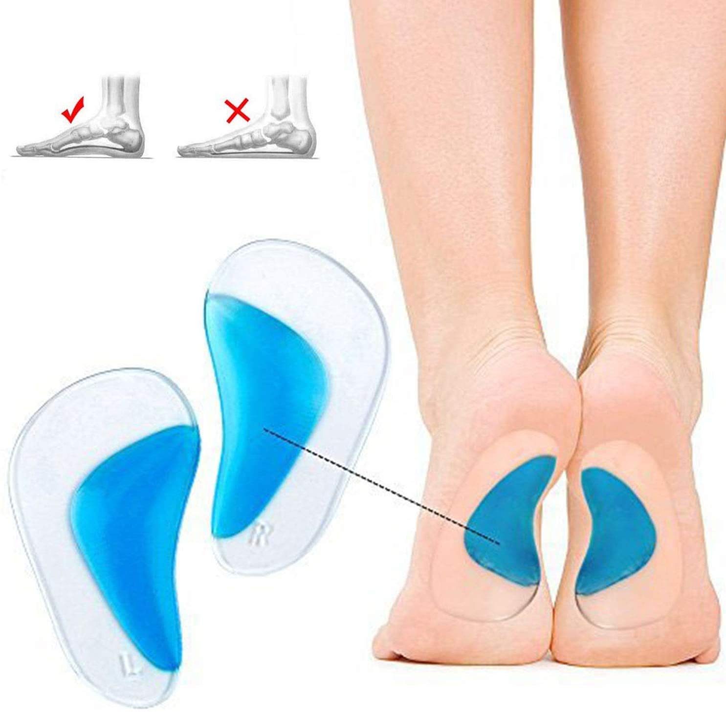 PedimendTM - Supporto per arco plantare pieghevole per piedi piatti sopra pronazione, 6 pezzi, inserti in gel di fascite plantare in silicone, per uomini e donne