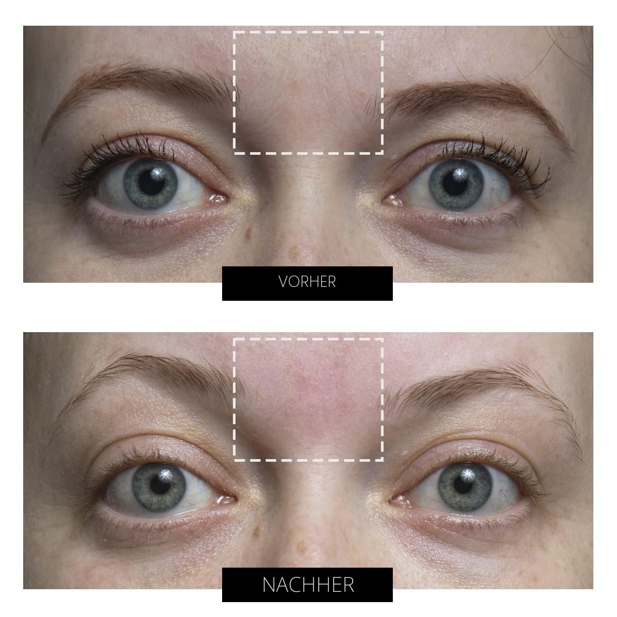 CurrentBody Haut-Radiofrequenzgerät | Gesichtstonungsgerät | Klinisch bewährte Technologie zur Hautstraffung und Anti-Aging