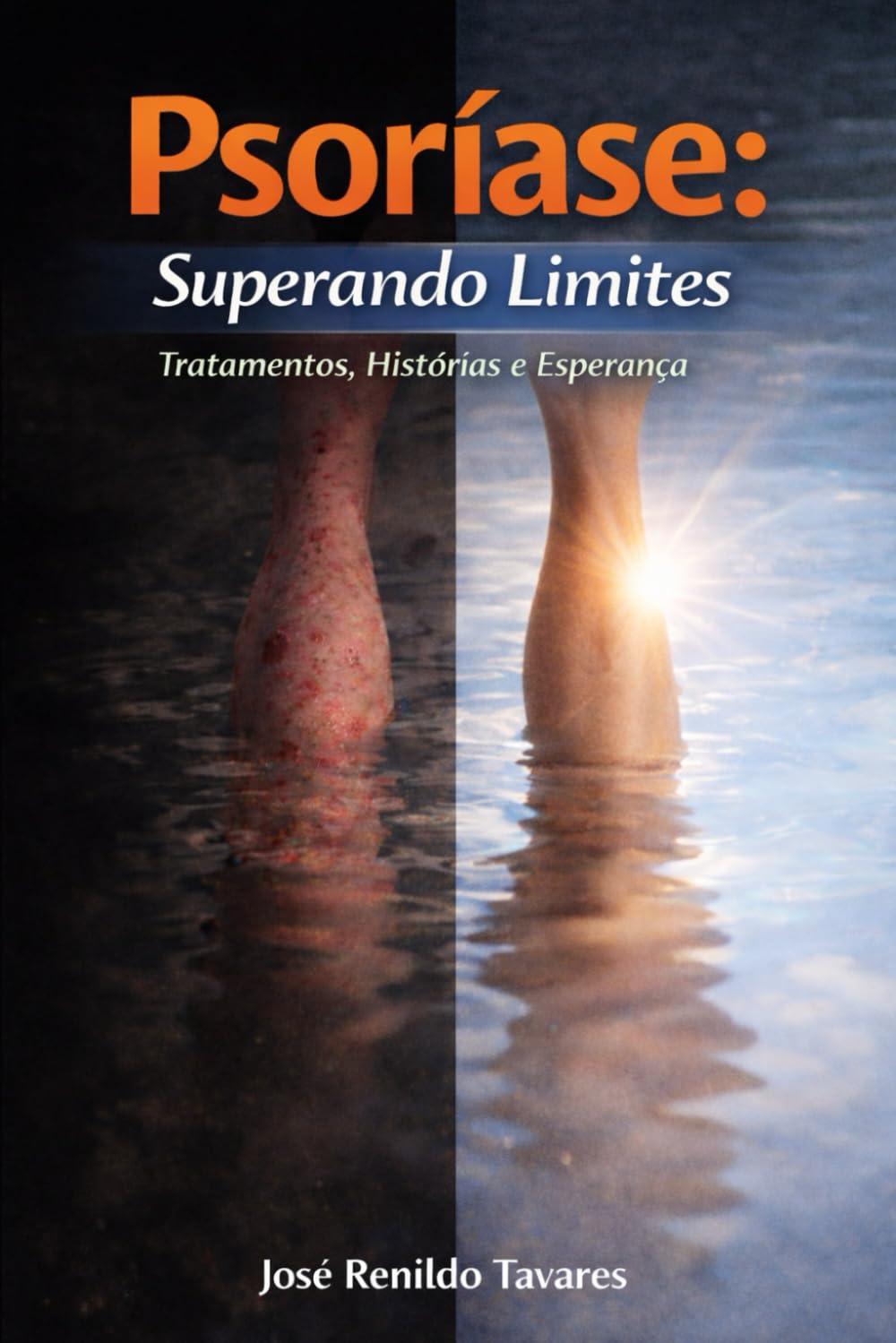 PSORÍASE: Superando Limites: Tratamentos, Histórias e Esperança