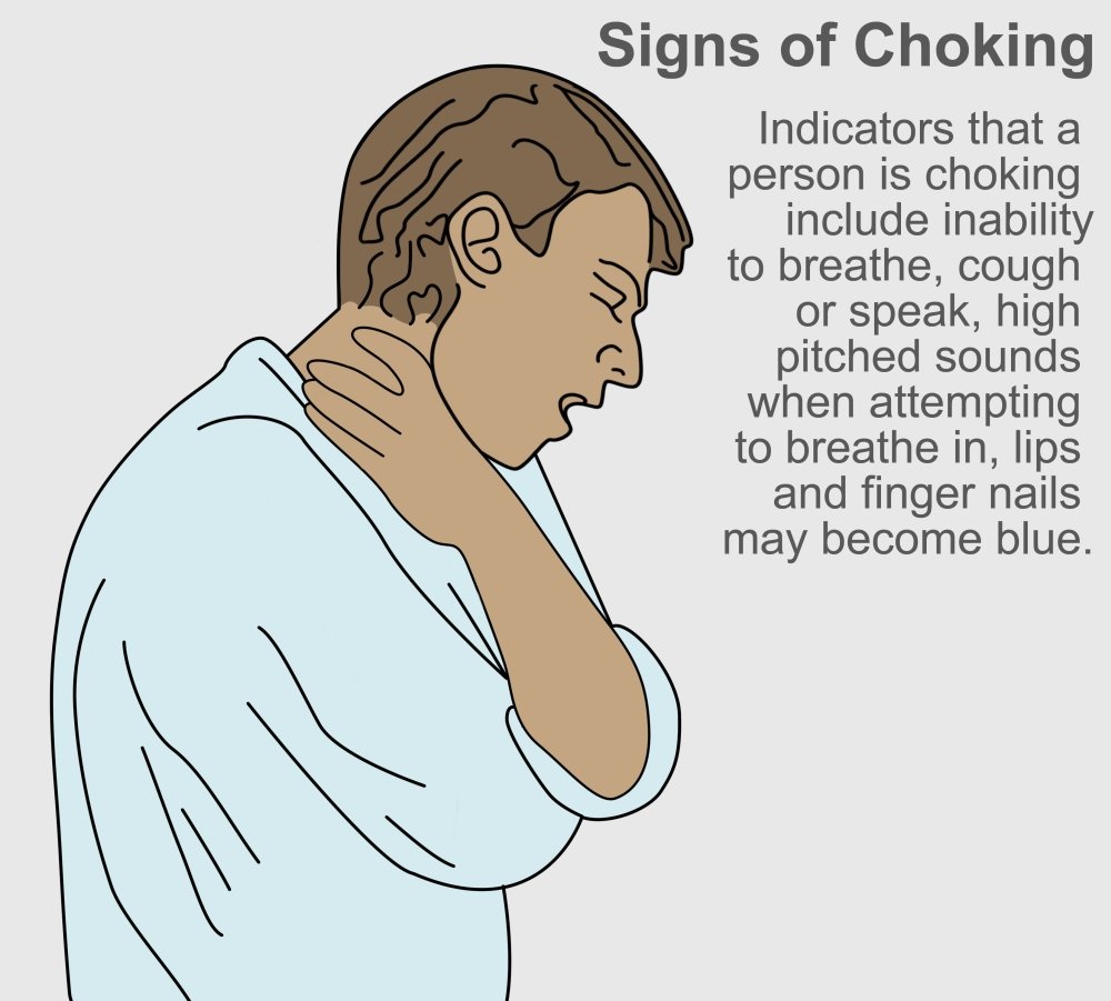 Recognizing and Responding to Choking