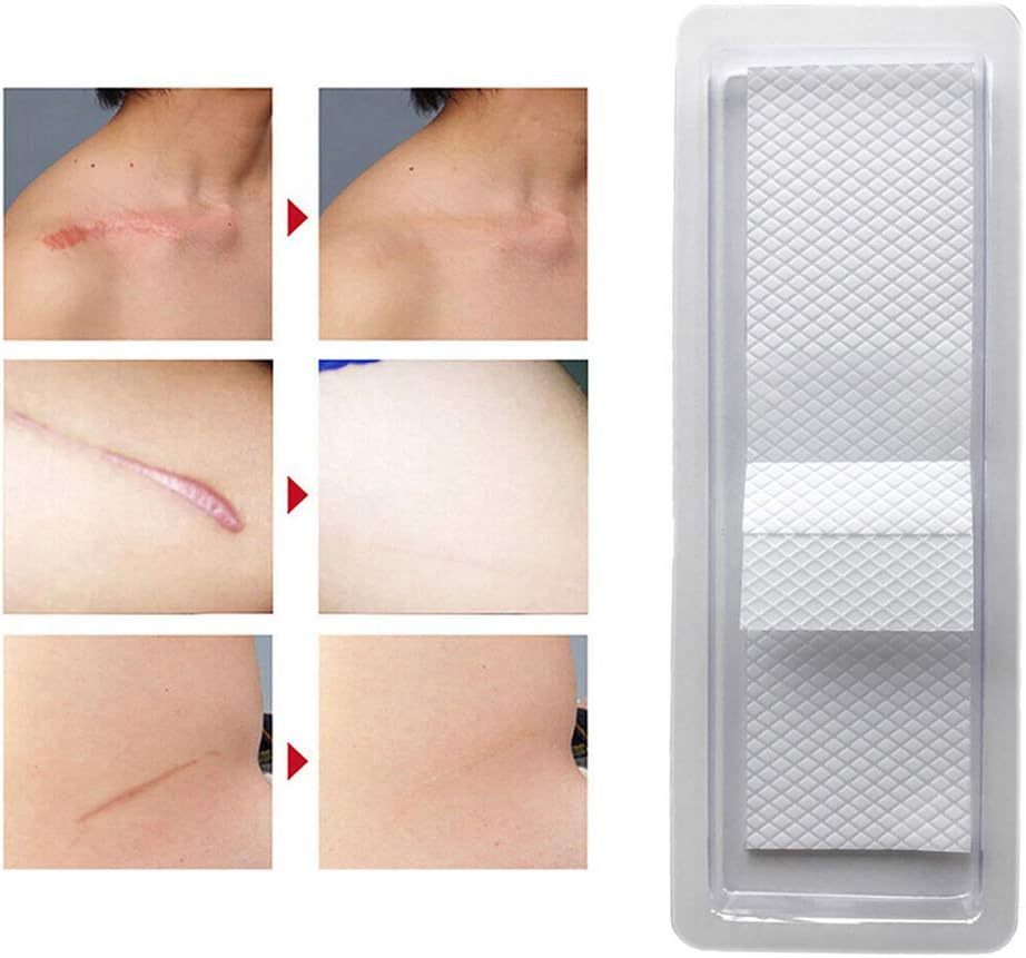 cicatrice in silicone per il viso