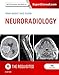 Neuroradiology: The Requisites E-Book (Requisites in Radiology)