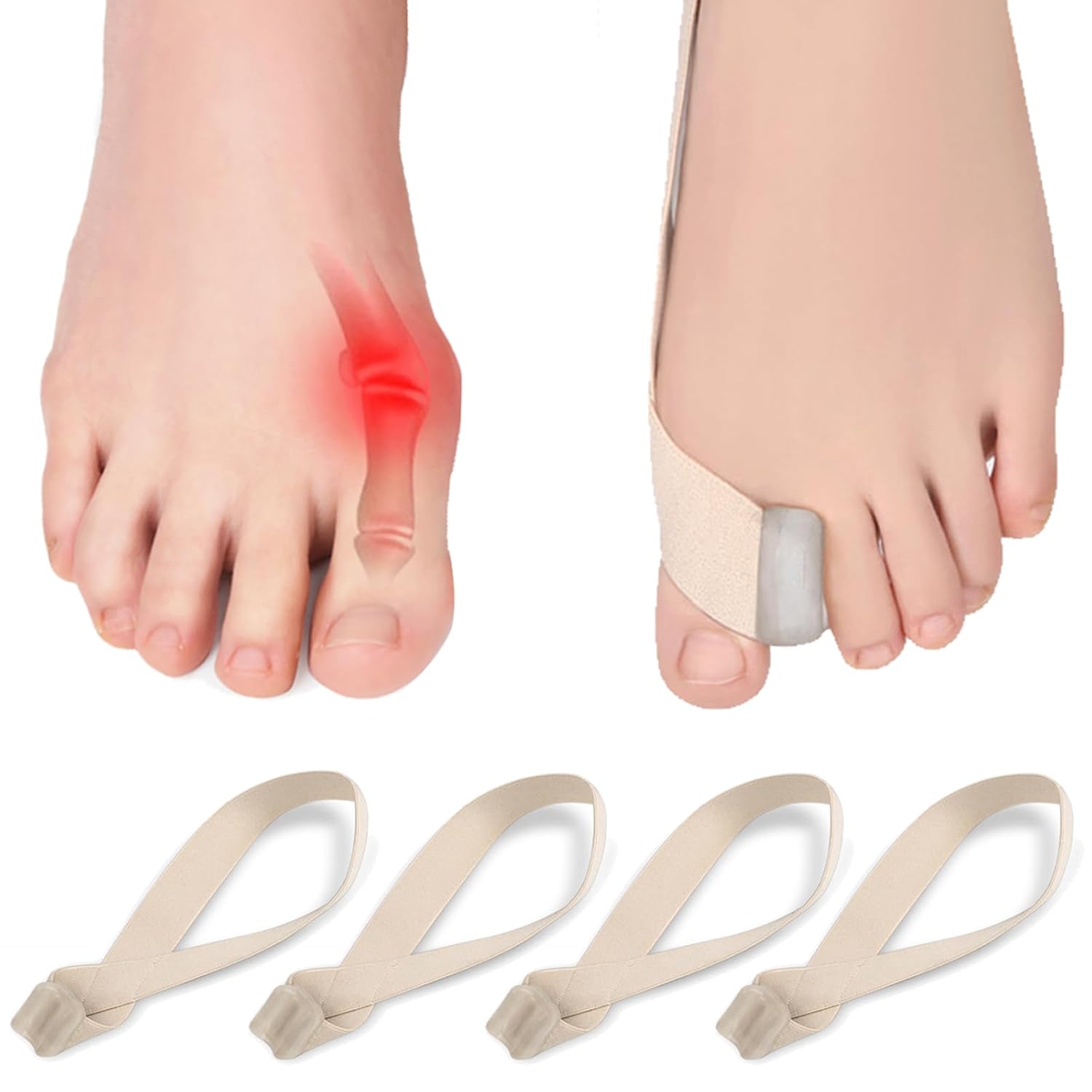 KIYOKI 4 Pack Bunion Corrector Big Toe Spacers, Toe