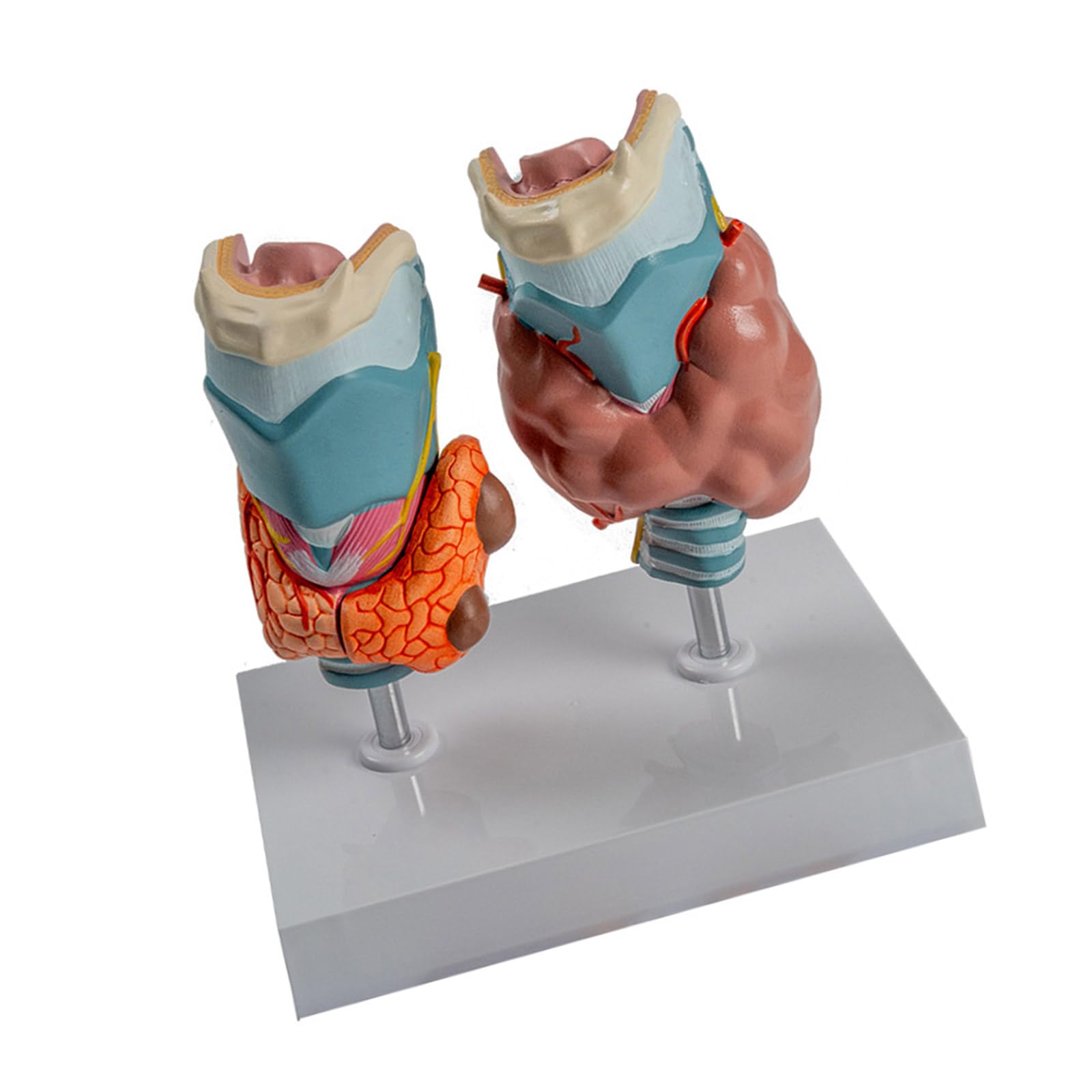 Modèle d'anatomie thyroïdienne pathologique humaine de haute précision - 8