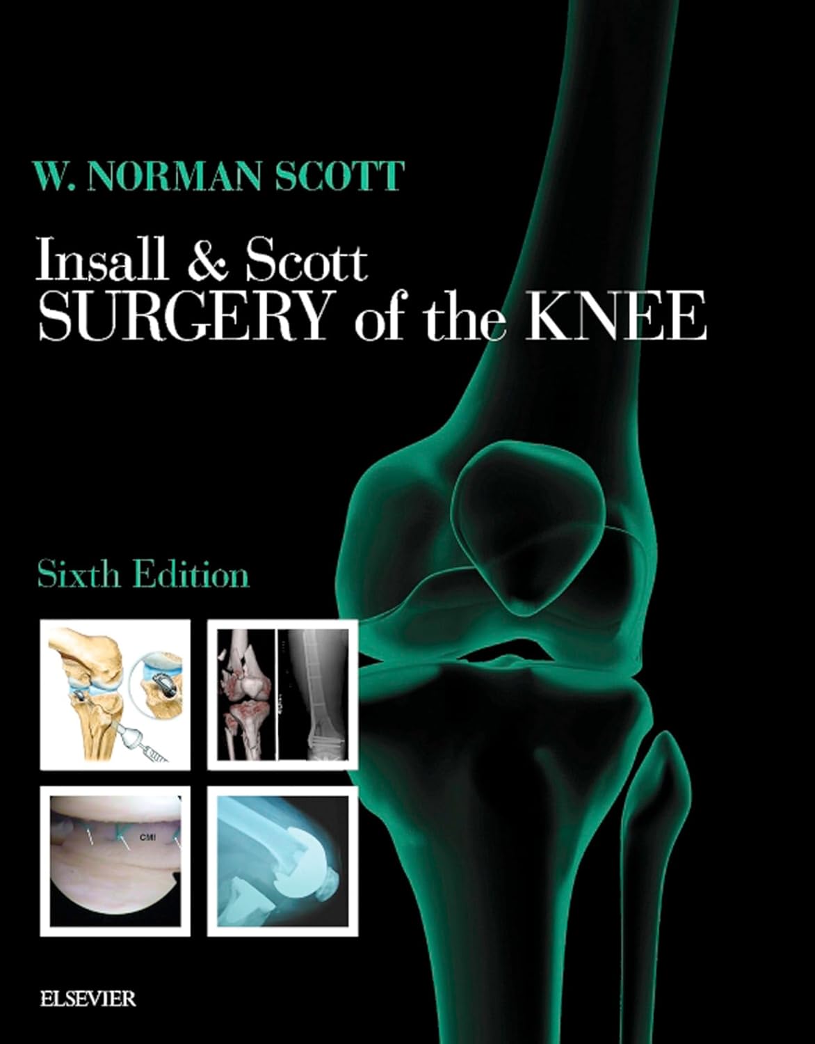 Insall & Scott Surgery of the Knee E-Book: Expert Consult - Online and Print      6th Edition, Kindle Edition