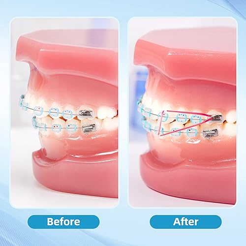 Miniatura 7 de Annhua Bandas elásticas de ortodoncia, 500 unidades (3.5 onzas, 1/4 pulgadas), bandas de tracción de goma dental, bandas para huecos dentales, aseo