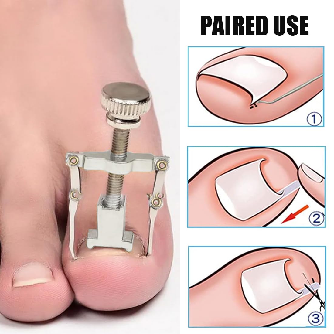 50 tiras alisadoras de uñas indoloras + corrector de uñas encarnadas, kit corrector de uñas encarnadas, levanta uñas, kit de herramientas para uñas fácil de usar