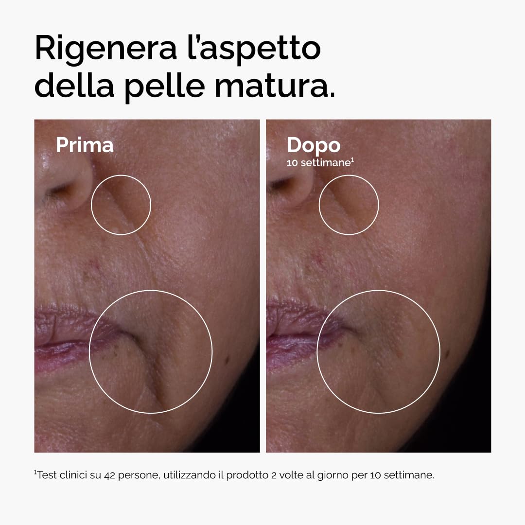 The Ordinary GF 15% Solution 30ml, Siero Fattori di Crescita, Formula anti-età per visibile miglioramento della pelle e delle rughe