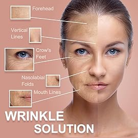 Akissos Forehead and Between Eyes Wrinkle Patches The Original Wrinkle Patch Non Invasive Wrinkle Smoothers for Forehead Wrinkles 5cm width