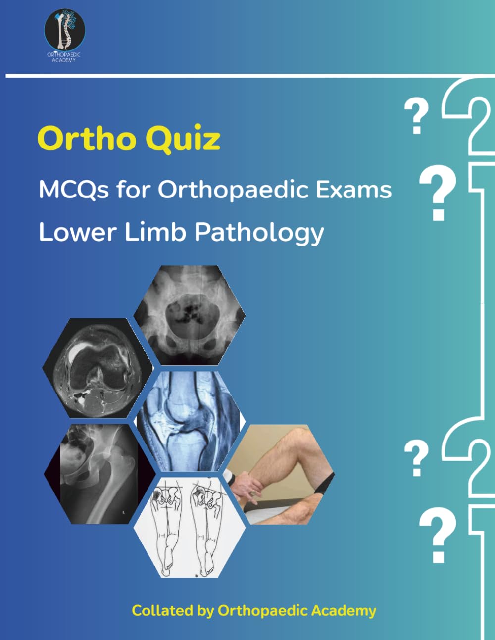 OrthoQuiz: Lower Limb Pathology (Concise Orthopaedics)