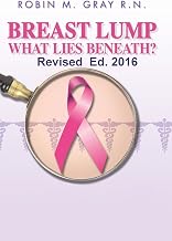 Breast Lump What Lies Beneath?: A Must Read To Help Obtain The Correct Diagnosis and Avoid The Common Pitfalls Of A Doctor Related Breast Cancer Misdiagnosis