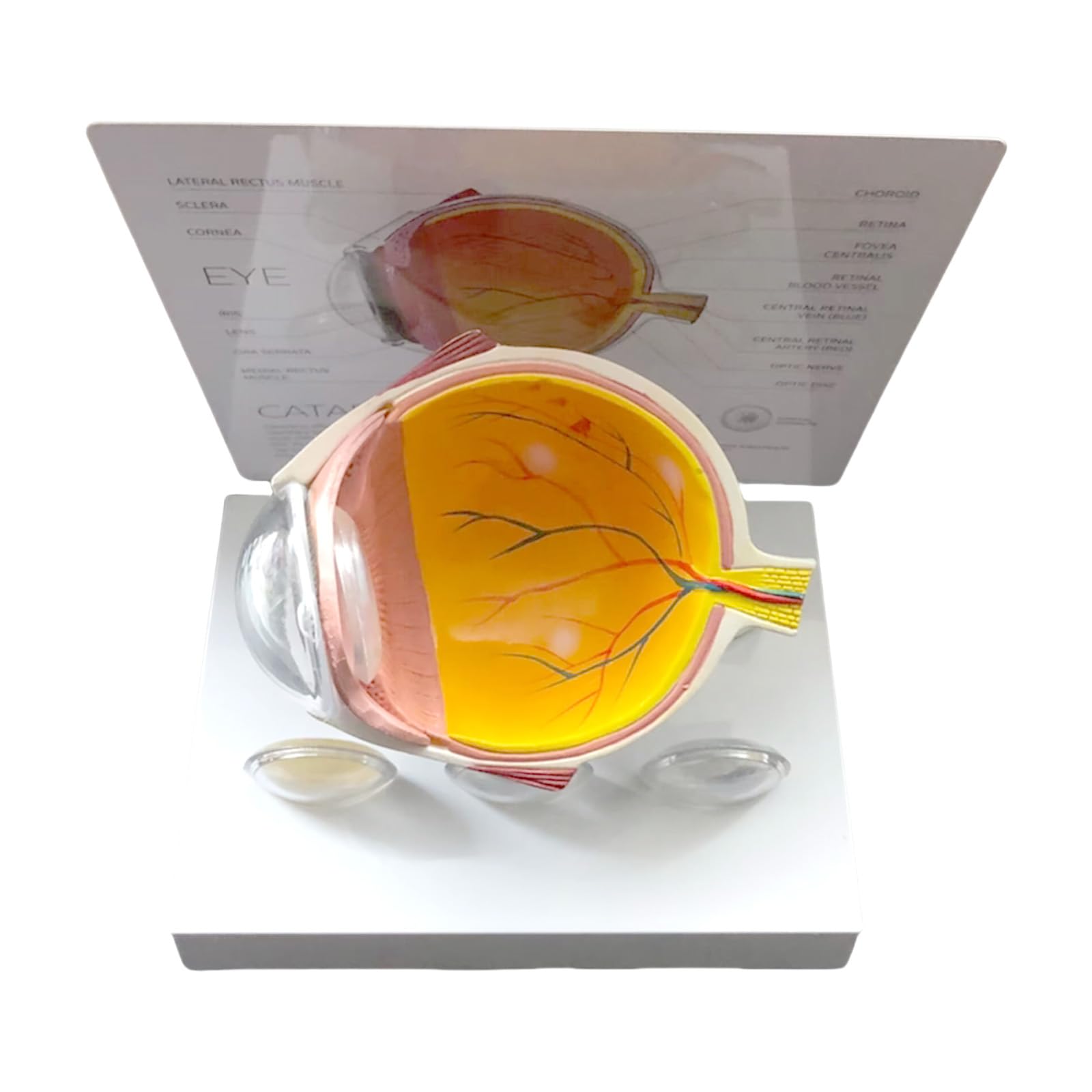 Ljmyy Human Anatomical Eye Model Pathological Anatomy Model for Clinical Setting Teaching Demonstration Lecture Report