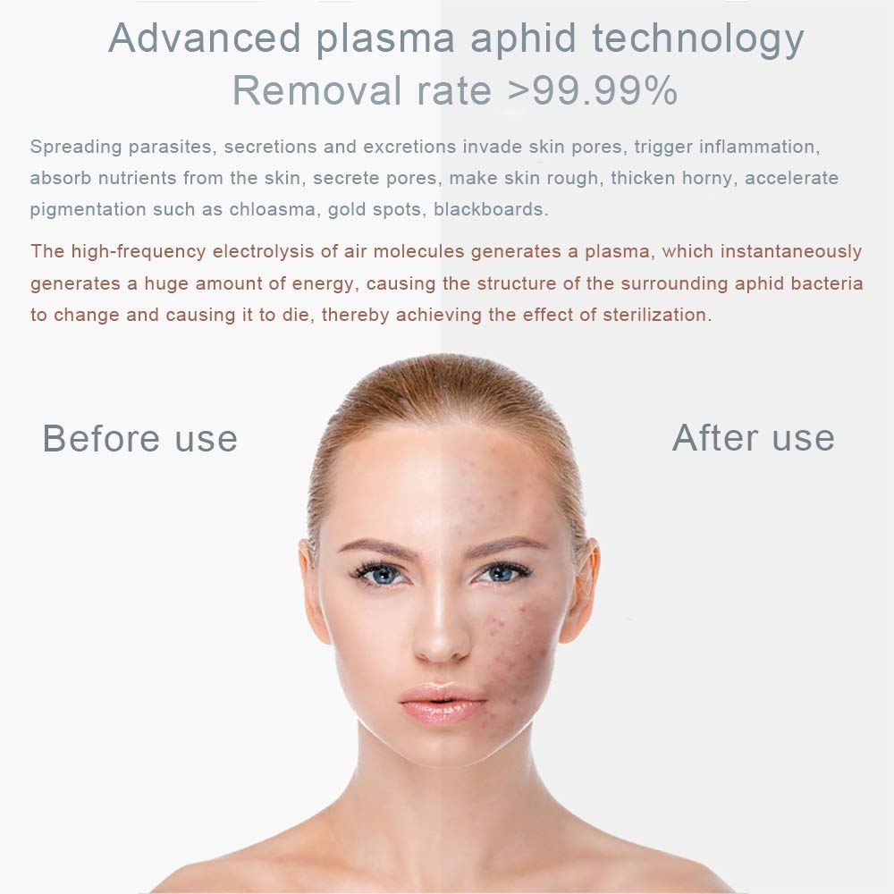 Strumento elettrico di bellezza, sterilizzazione per acne, rughe, plasma facciale antietà oltre allo strumento di bellezza per acari, altamente permeabile, nessuna radiazione non danneggia la pel