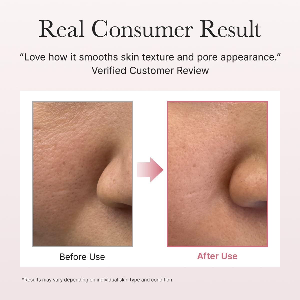 ARENCIA Red Smoothie Lotion Face Moisturizer with 5% Niacinamide and Peptides