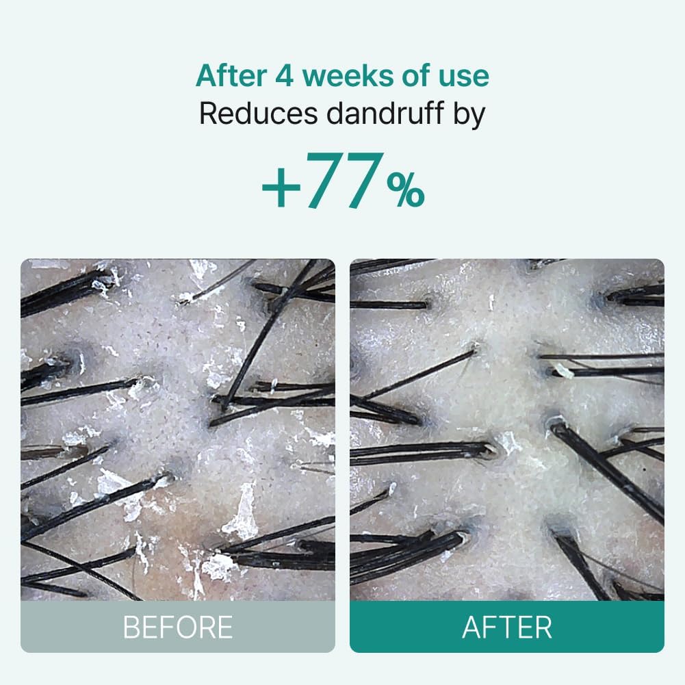 lilyeve SCALPTURN Cica PDRN Scalp Serum with Built-in Brush, PDRN to Strengthen Hair Roots, Itchy Scalp Relief, Dry Scalp Hydration - Korean Hair Care, 3.38 fl.oz (Pack of 3)