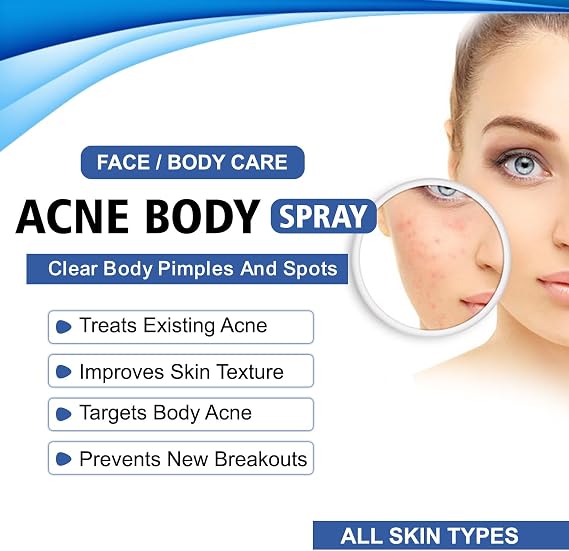 Acne Body for Face & Body – Clear Skin Treatment, Reduces Acne Breakouts, Soothes Irritation – Fast Absorbing & Non-Greasy Formula – Men & Women (50ml)