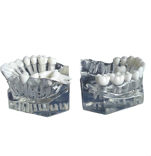 Miniatura 3 de Modelo de enseñanza de estudio de dientes dentales - Modelo de educación dental de ciencias médicas - Modelo de dientes de demostración Ypodont con