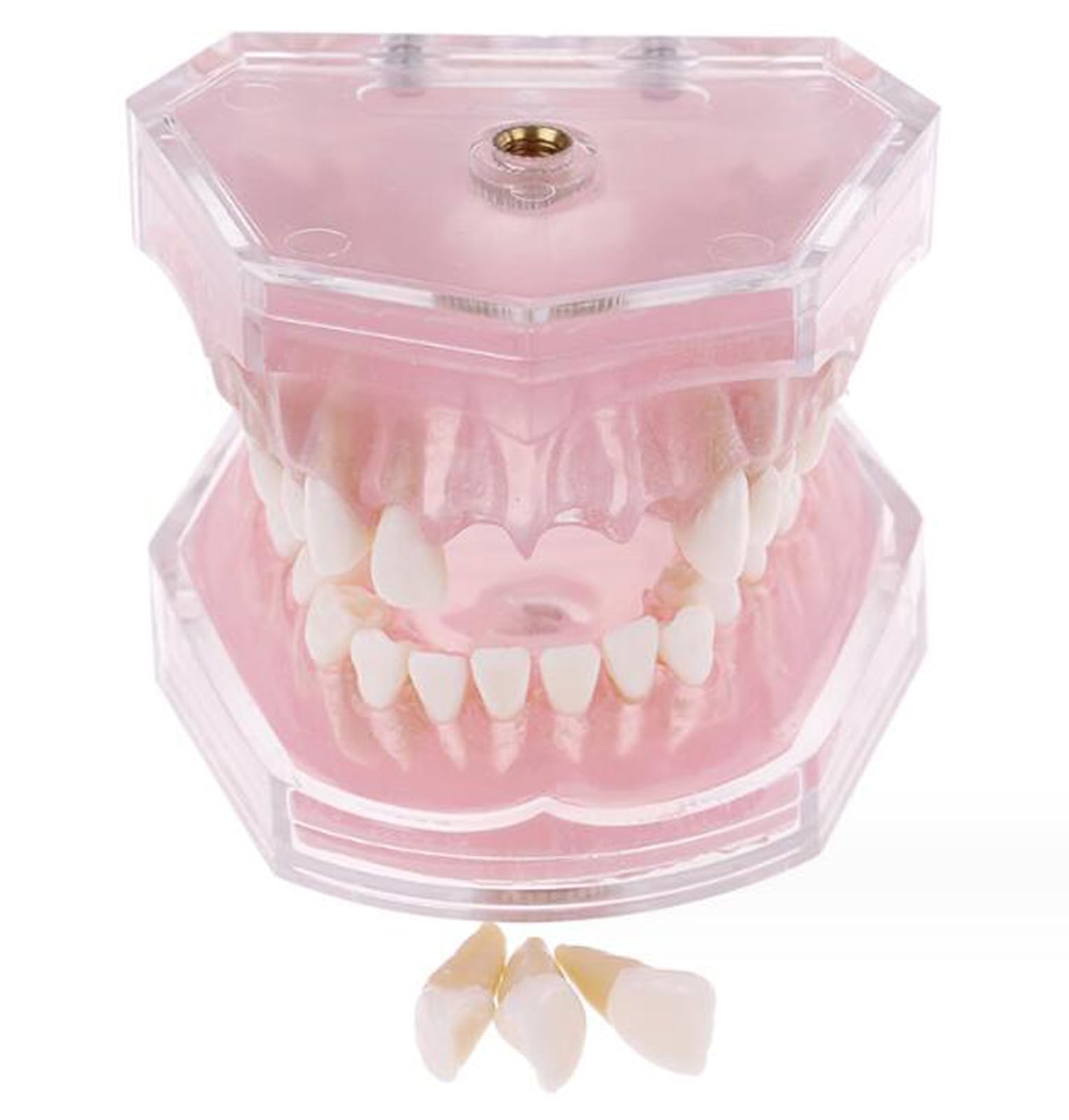 Modelo dental con dientes extraíbles, bandeja suave estándar, modelo dental extraíble, herramienta de enseñanza de materiales de laboratorio dental ideal