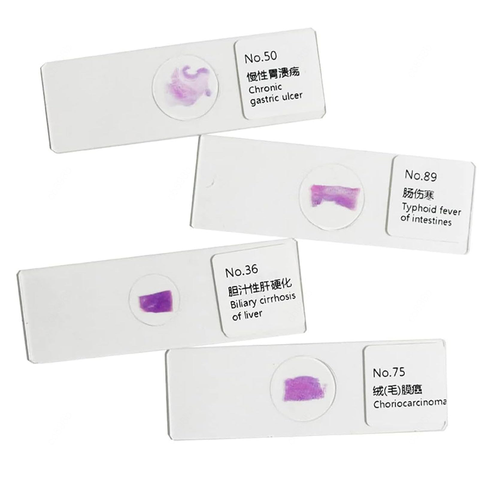 100 Piezas de Muestra de Sección Patológica Humana, Portaobjetos de Observación de Microscopio, Rebanadas Claramente Estructuradas, Material de Vidrio para Enseñanza de Educación de Estudios