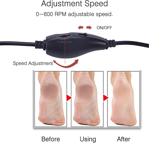 Miniatura 6 de Removedor eléctrico de callos de pies, amoladora electrónica de archivos de pies con velocidad ajustable y 60 discos de papel de lija de repuesto,