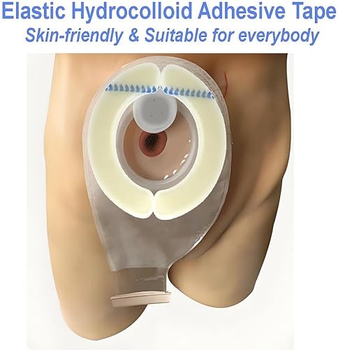 Miniatura 3 de 20 tiras de barrera para ostomía, tiras de sellado adhesivas para bolsas de colostomía, fugas impermeables hidrocoloides, cinta adhesiva sensible a