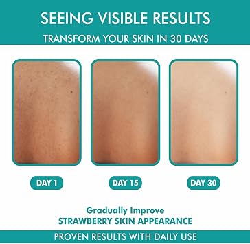 Generic Back Acnee.- Spray | 02% Salicylic & 5% Niacinamide | Fast-Acting Body Acnee Solution | Spray for Bacne, Chest, Shoulder Acnee | Clears Pores & Reduces Breakouts | 100ml
