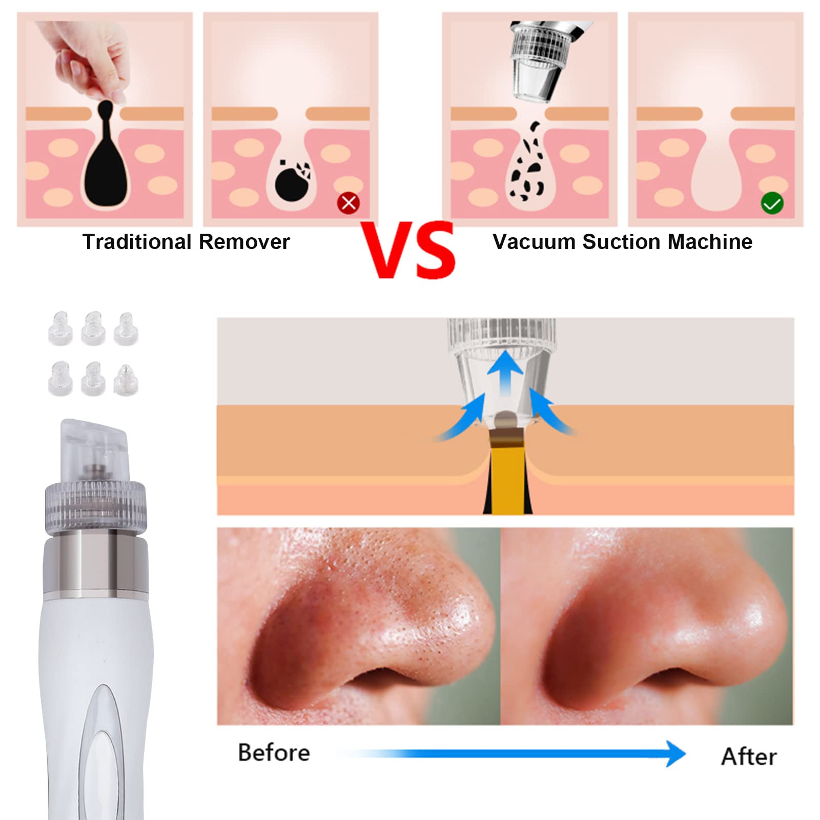 OUENGK Hydrogen Oxygen Facial Beauty Machine, 7 in 1 Professional