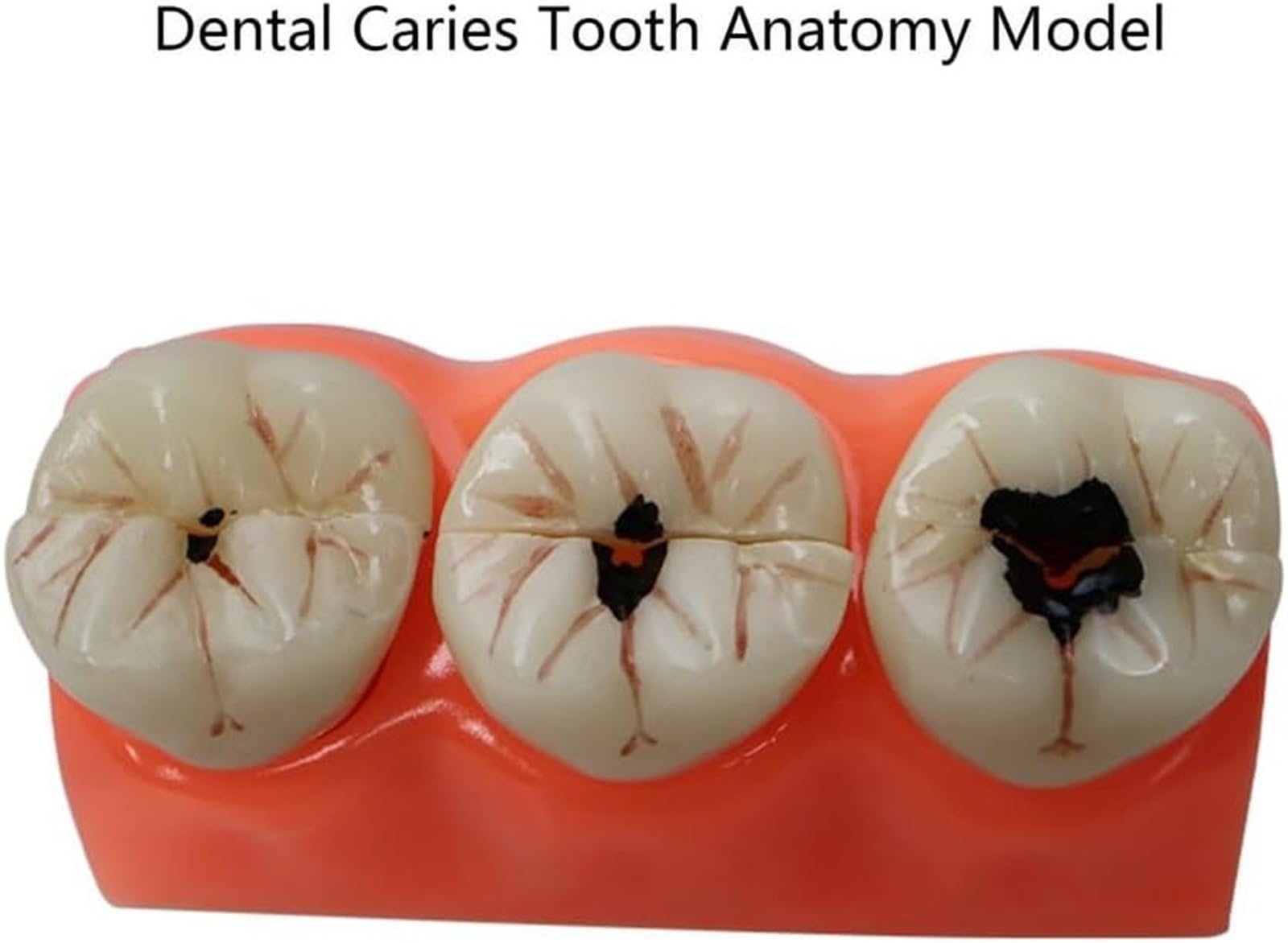 Standardowy model zębów dla dorosłych dentystów, realistyczny projekt symulacji i doskonałe wykonanie do nauczania, akcesoria do próchnicy zębów dla dentystów, nauczycieli uczniów nauczania anatomii