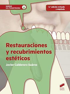 Restauraciones y Recubrimientos Esteticos