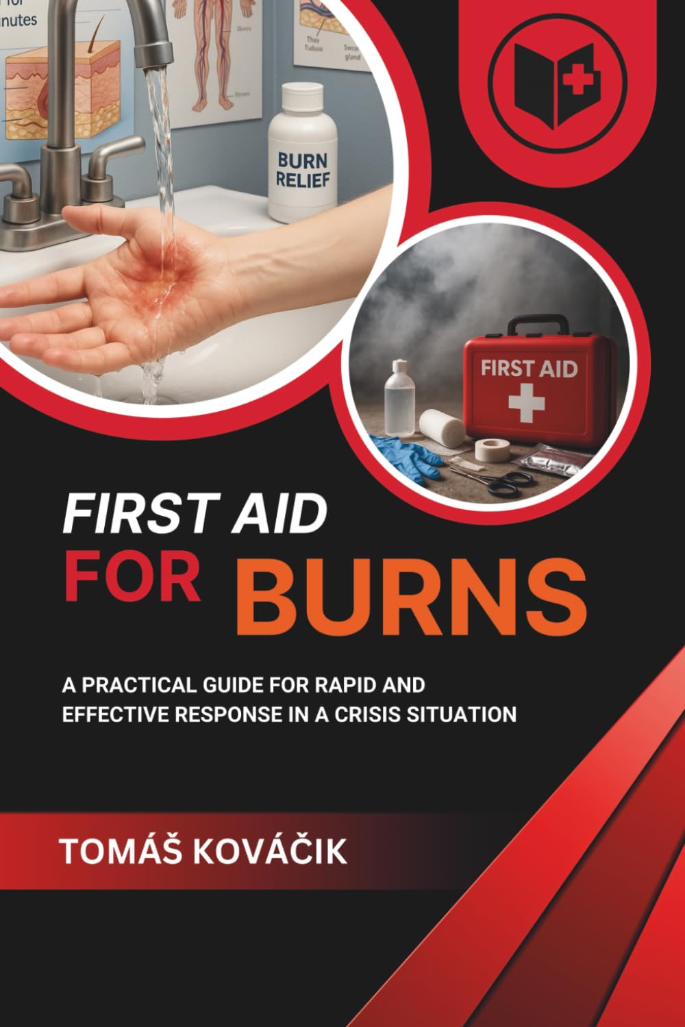 First aid for burns: A practical guide for rapid and effective response in a crisis situation