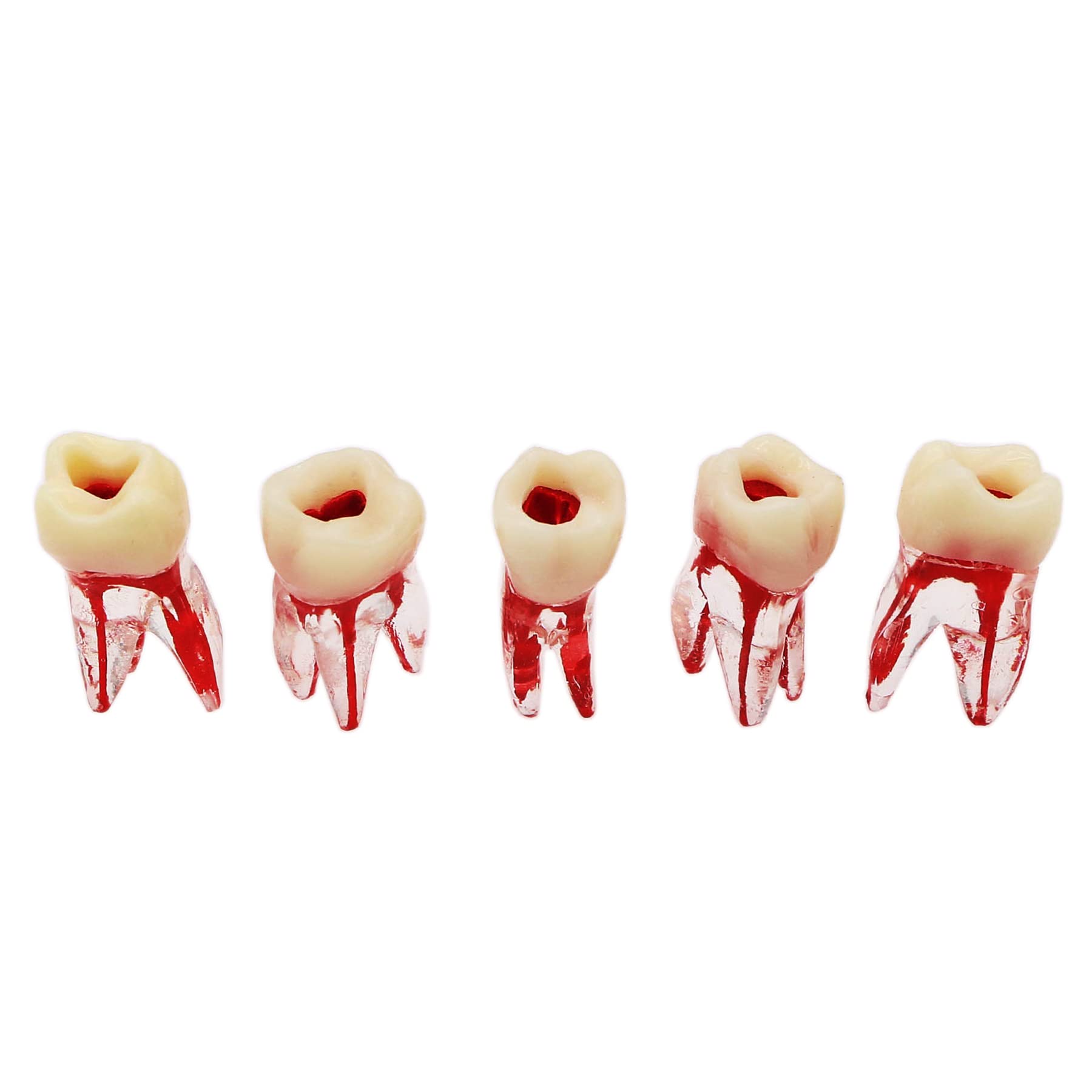 Dental Root Canal Pulp Cavity Practice Endodontic Pulp-Opened RCT Teeth Model M8008 16# Typodont Standard 1:1 Teach Study 5 Pcs