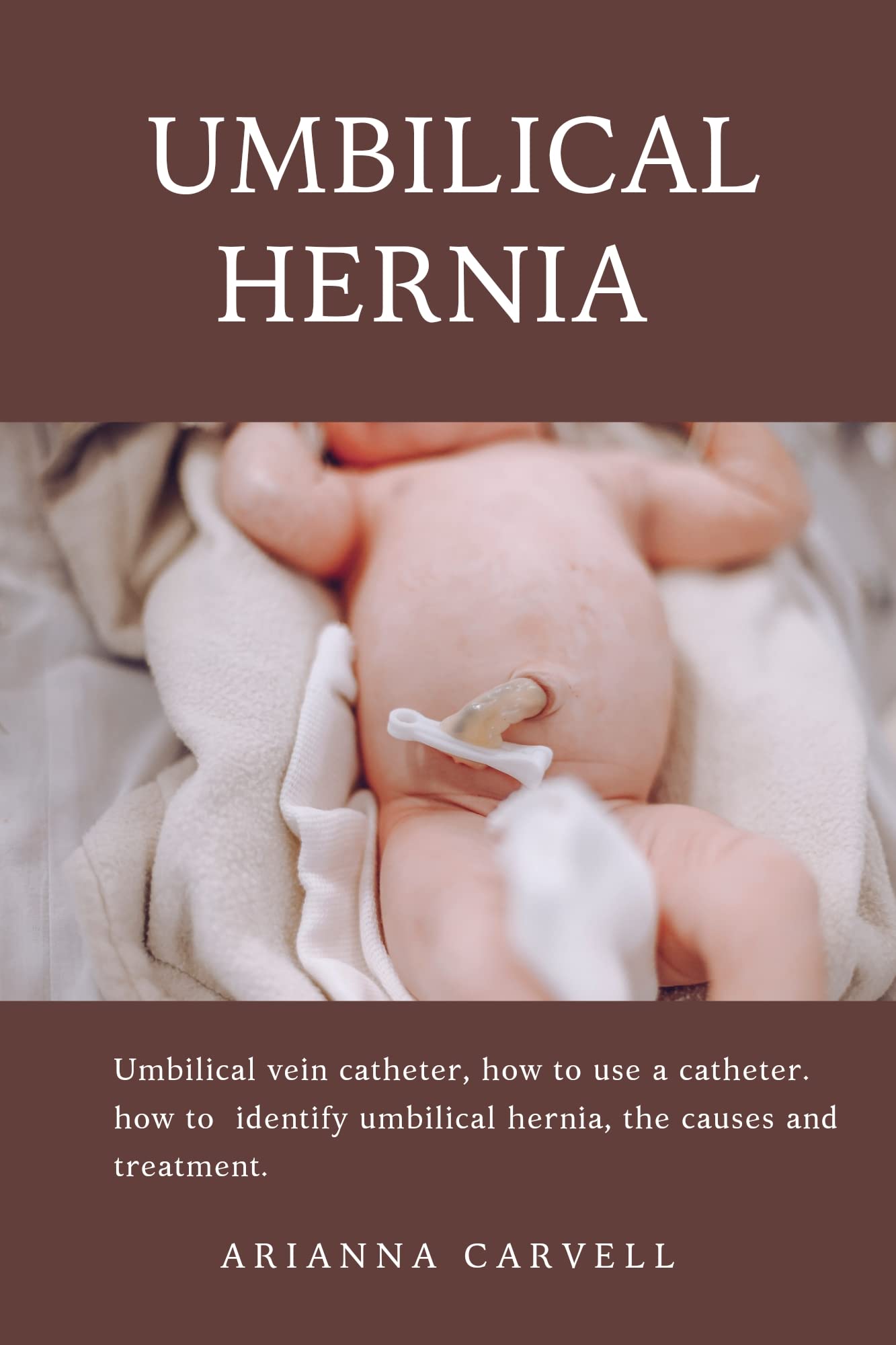 Buy Umbilical hernia umbilical vein catheter, how to use a vein