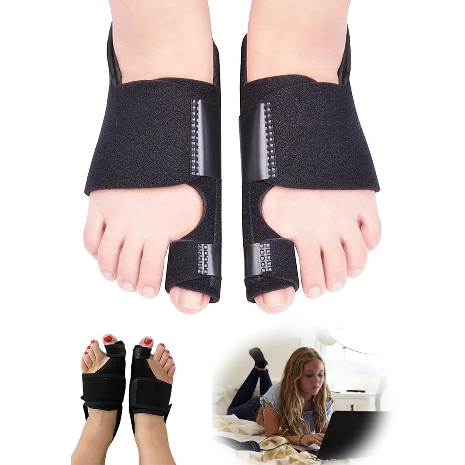 X springBunion Corrector, Adjustable Bunion Relief Protector Sleeves Kit, 1 Pair Bunion Splints Big Toe Straightener, Non Surgical Hallux Valgus Correction Hammer Toe Straightener for Men and Women