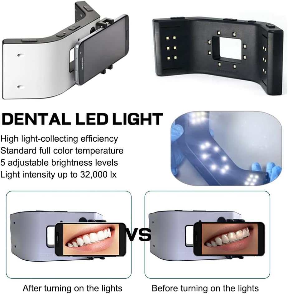 Mobile Dental Photography Light, Dental Photography Filling Light with 20 LED Lights Dental Photography Aid 6000-6500K Adjustable