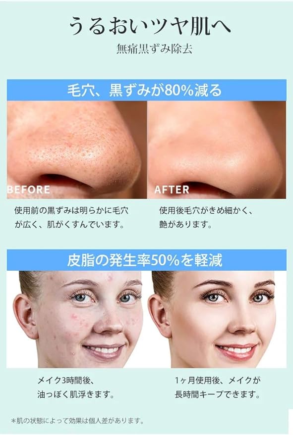 Amazon Co Jp 年最新 毛穴吸引器 毛穴クリーナー ニキビ吸引 毛穴ケア 角栓 汚れ除去 シワ減少 黒ずみ吸出 毛穴クリーン 角栓 たるみ改善 5階段吸引力 4種類の吸引ヘッド Usb充電式 Ledディスプレイ ビューティー Amazon Co Jp 年最新 毛穴吸引器 毛穴クリーナー ニキビ吸引 毛穴ケア 角栓 汚れ除去 シワ減少 黒ずみ吸出 毛穴クリーン 角栓 たるみ改善 5階段吸引力 4種類の吸引ヘッド Usb充電式 Ledディスプレイ ビューティー
