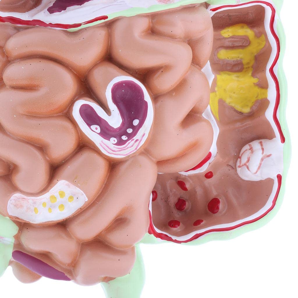Anatomía del Sistema Digestivo Humano Modelo de Enseñanza Anatómica Estudio Anatómico