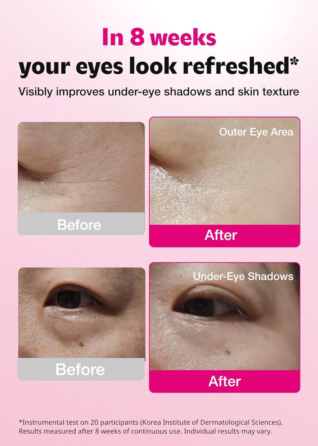 ISOI Blemish Care Under Eye Patch, patch contorno occhi per occhiaie, gonfiore e rughe, maschere occhi in gel idratante con acido ialuronico e olio di rosa bulgara (Rosso, 90 pezzi, 3,17 oz)