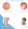 KELO-COTE KIDS Silicone Scar Gel 6g for Babies from 3 Months for Scars After Injuries Burns Surgical Procedures and Raised Bulging Scars such as Hypertrophic Scars and Keloids