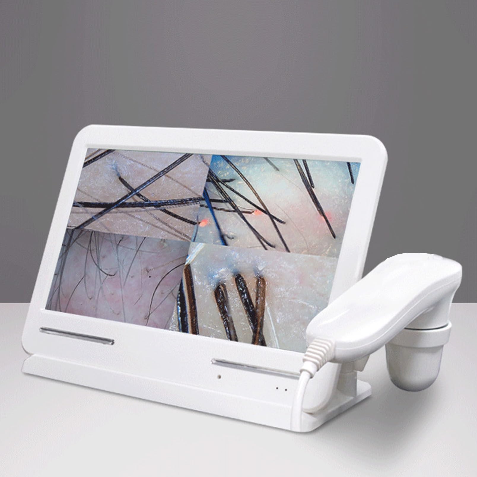 Macchina per l'analisi dei capelli e della pelle, tester HD, tester per l'analisi del cuoio capelluto, telecamera con lente d'ingrandimento