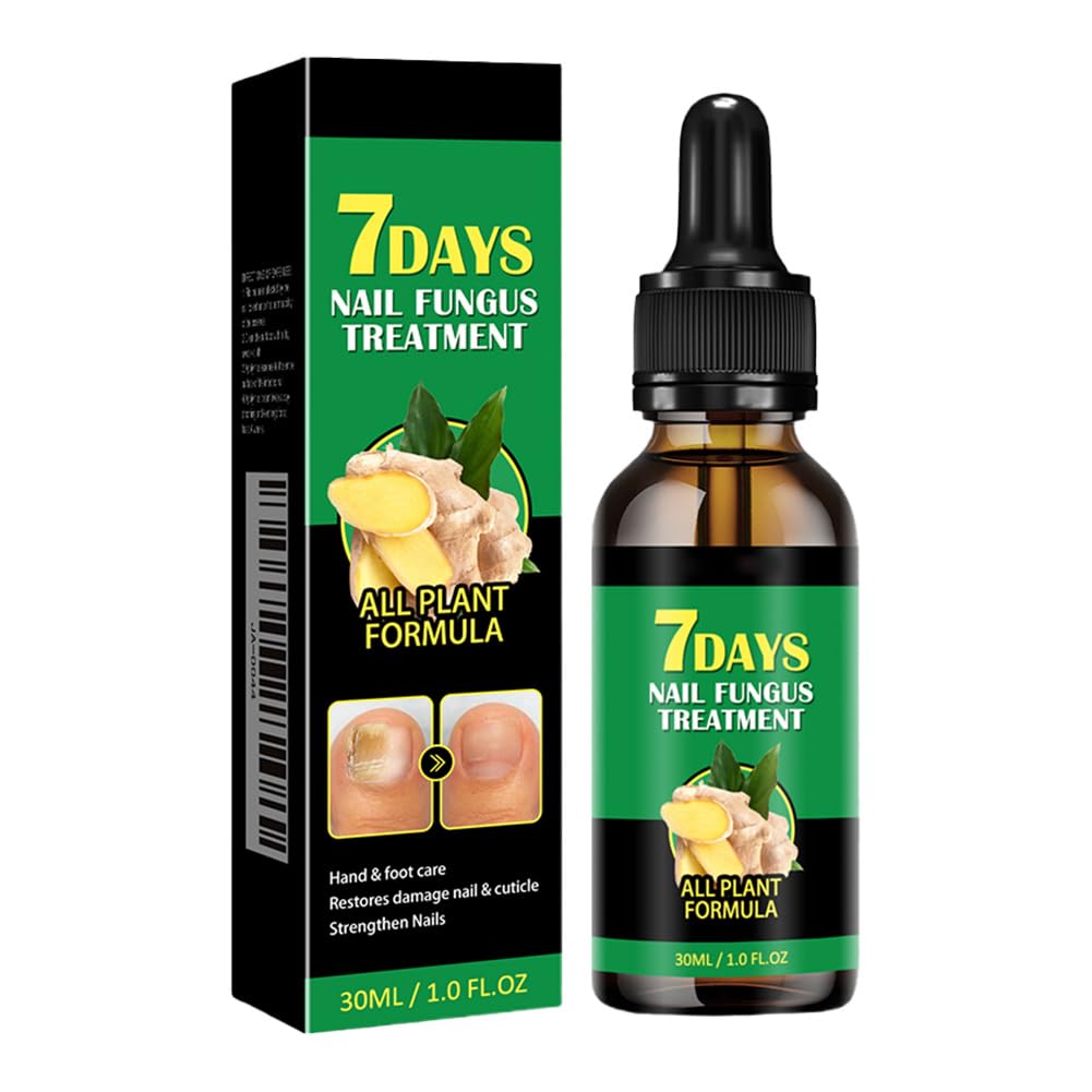 Siero per Unghie allo Zenzero da 30 ml, Siero per Unghie Rinforzante e Riparatore, Olio per Unghie allo Zenzero per Rafforzare le Unghie