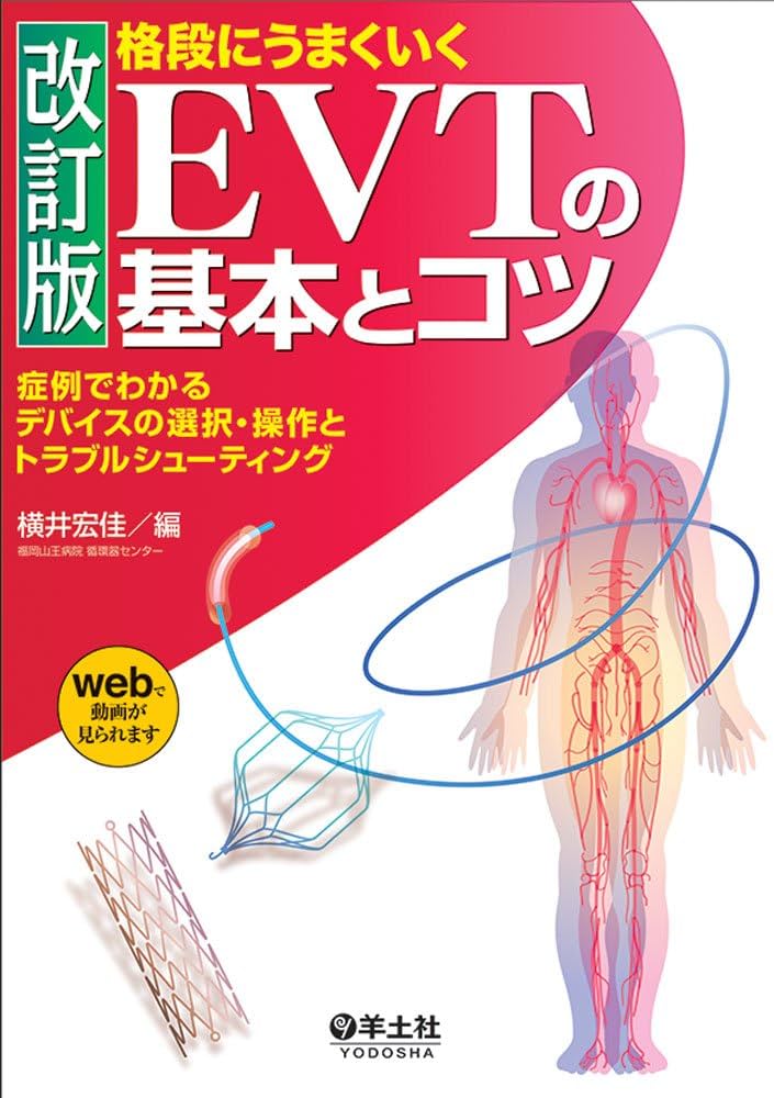 格段にうまくいくＥＶＴの基本とコツ 症例でわかるデバイスの選択・操作とトラブルシ 改訂版 格段にうまくいく EVTの基本とコツ〜症例でわかる