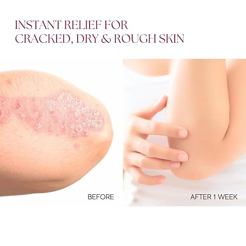 Miniatura 4 de DT Crema de colágeno para manos y pies, hidratación intensiva con urea y colágeno, 4 onzas, sin parabenos