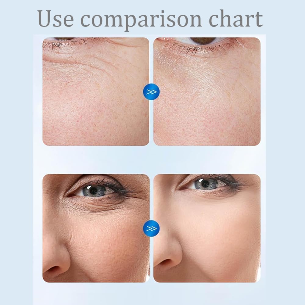 Amazon.com: Dermaxea Hyaluronic Serum,Hyaluronic Acid Tubes, Ultra