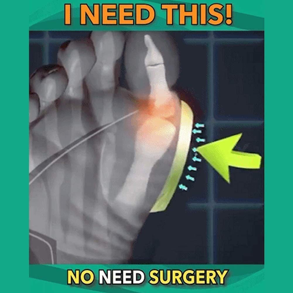 Sandalias de corrección ósea del Dedo Gordo del pie para Mujer Zapatos ortopédicos de Piel de Vaca con Punta Abierta Zapatillas correctoras de juanetes Hallux Valgus con Soporte de Arco para