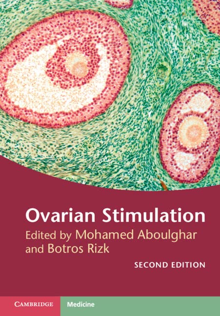 Ovarian Stimulation      2nd Edition, Kindle Edition