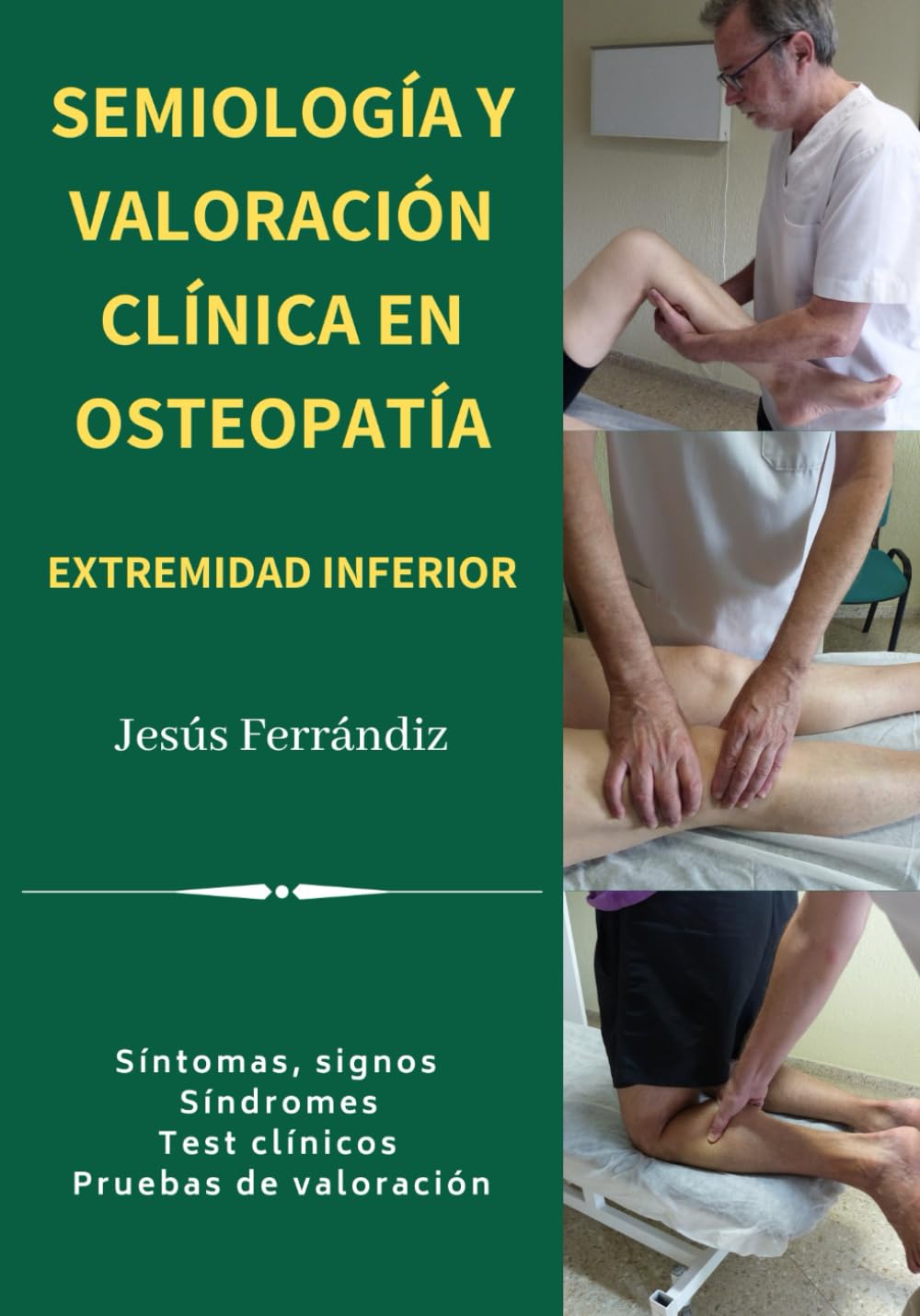 SEMIOLOGÍA Y VALORACIÓN CLÍNICA EN OSTEOPATÍA EXTREMIDAD INFERIOR: Síntomas, signos. Síndromes. Test clínicos. Pruebas de valoración