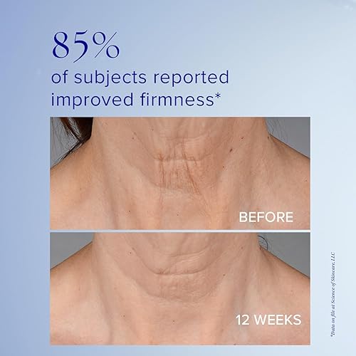 Miniatura 3 de iS CLINICAL Neckperfect Complex, Crema reafirmante para el cuello, lifting de cuello antienvejecimiento, crema para tensar el cuello