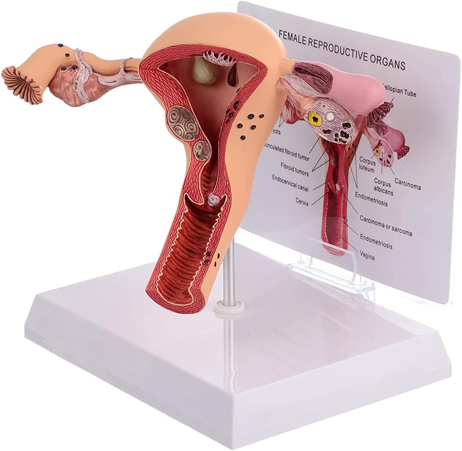 Modello del sistema riproduttivo femminile umano - Modello 3D di anatomia dell'utero e dell'ovaio per insegnamento e apprendimento, strumento educativo per studenti e professionisti sanitari