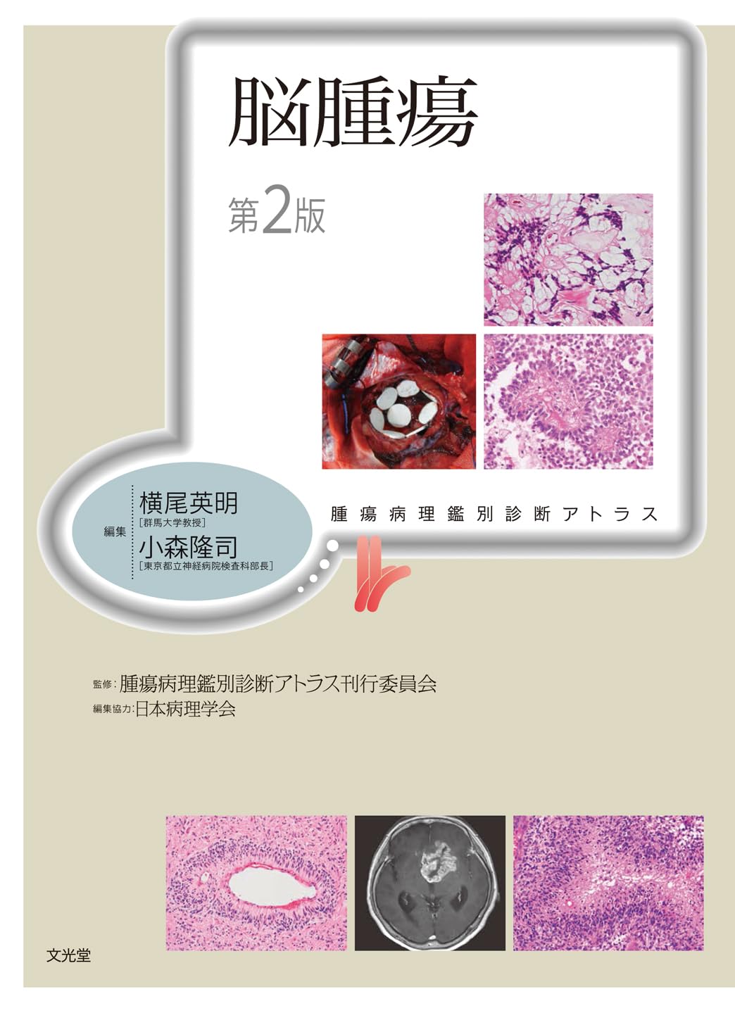 腫瘍病理鑑別診断アトラス 造血器腫瘍 第2版 裁断済み 造血器腫瘍 第2 