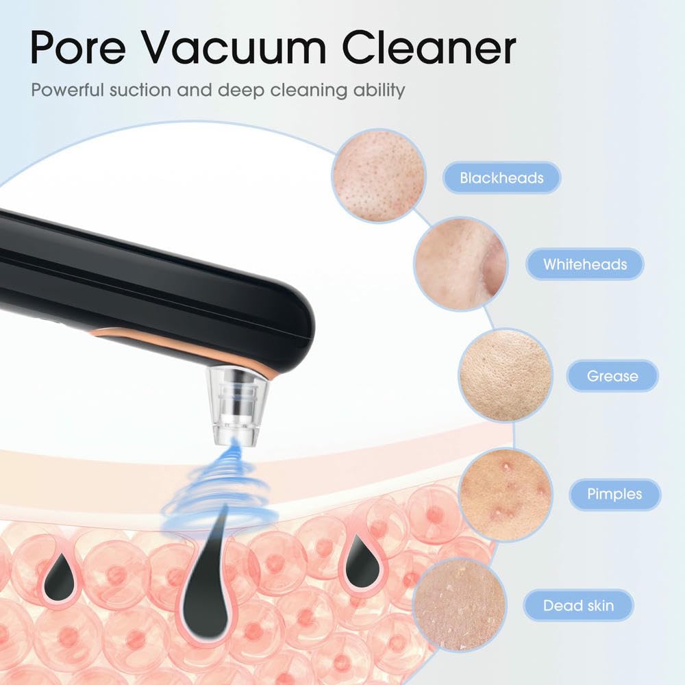 NYSDM - Aspirapolvere Elettrico per la rimozione dei Punti Neri, Strumento per la Pulizia Profonda dei pori, Compatto e con Display, per la Pulizia Profonda del Viso, per Rimuovere l'acne